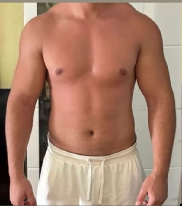 Espacio reservado para foto de transformación de cliente