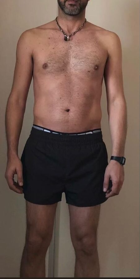 Espacio reservado para foto de transformación de cliente