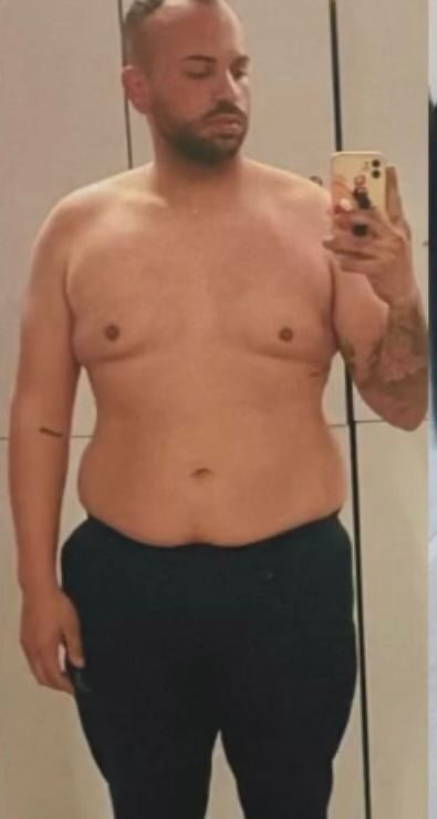 Espacio reservado para foto de transformación de cliente